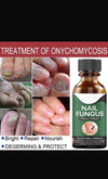Fast Nail Fungus Treatment Serum – Nail Repair Essence for Finger & Toenail Care (All-Natural Formula)